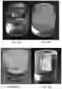 Fig. 07 - Composite scintillators