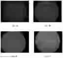 Fig. 11 - Electroporation, developmentally-activated cells, pluripotent-like cells, cell reprogramming and regenerative medicine