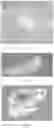 Fig. 16 - Electroporation, developmentally-activated cells, pluripotent-like cells, cell reprogramming and regenerative medicine