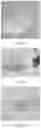Fig. 17 - Electroporation, developmentally-activated cells, pluripotent-like cells, cell reprogramming and regenerative medicine