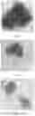 Fig. 21 - Electroporation, developmentally-activated cells, pluripotent-like cells, cell reprogramming and regenerative medicine