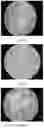 Fig. 30 - Electroporation, developmentally-activated cells, pluripotent-like cells, cell reprogramming and regenerative medicine