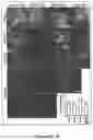 Fig. 05 - INDUCED PLURIPOTENT CELL-DERIVED OLIGODENDROCYTE PROGENITOR CELLS FOR THE TREATMENT OF MYELIN DISORDERS