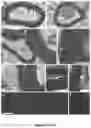 Fig. 12 - INDUCED PLURIPOTENT CELL-DERIVED OLIGODENDROCYTE PROGENITOR CELLS FOR THE TREATMENT OF MYELIN DISORDERS