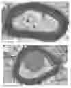 Fig. 01 - Induced pluripotent cell-derived oligodendrocyte progenitor cells for the treatment of myelin disorders