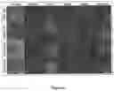 Fig. 03 - Induced pluripotent cell-derived oligodendrocyte progenitor cells for the treatment of myelin disorders