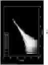 Fig. 04 - Single cell bar-coding for antibody discovery