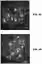 Fig. 03 - Methods to detect motor neuron disease comprising micro-RNAs