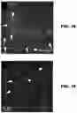 Fig. 04 - Methods to detect motor neuron disease comprising micro-RNAs