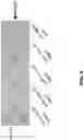 Fig. 16 - Methods to detect motor neuron disease comprising micro-RNAs