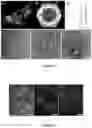 Fig. 04 - Virus-like particles and uses thereof