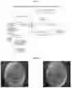 Fig. 02 - BACILLUS MUCILAGINOSUS AND HIGH-DENSITY FERMENTATION METHOD AND USE THEREOF