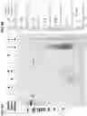 Fig. 09 - METHOD FOR NUCLEIC ACID AMPLIFICATION