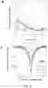 Fig. 13 - Methods of detecting cell-free DNA in biological samples
