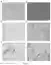 Fig. 07 - Methods and systems for assessing proliferative potential and resistance to immune checkpoint blockade