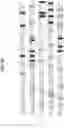Fig. 13 - Digital sequence analysis of DNA methylation
