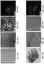 Fig. 16 - Method and system for growth of graphene nanostripes by plasma enhanced chemical vapor deposition