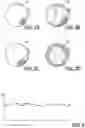 Fig. 03 - LAUNDRY TREATING DEVICE AND METHOD FOR ITS OPERATION