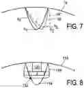 Fig. 05 - LAUNDRY TREATING DEVICE AND METHOD FOR ITS OPERATION