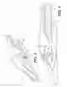 Fig. 04 - Implement tip assembly having tip with support rib
