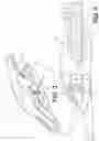 Fig. 04 - Implement ground engaging tip assembly having tip with tapered retention channel