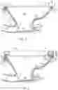 Fig. 03 - Toilet with non-vitreous flush engine