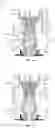 Fig. 11 - Subsea module and downhole tool