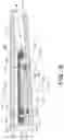 Fig. 06 - System for limiting radial expansion of an expandable seal
