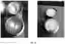 Fig. 09 - Method of Assuring Dissolution of Degradable Tools