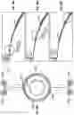 Fig. 23 - Peristaltic micropump and related systems and methods