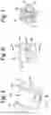 Fig. 05 - HYDRAULIC OPERATING DEVICE FOR A CYCLE OR FOR A MOTORCYCLE COMPRISING A DISTRIBUTION BODY OF HYDRAULIC FLUID