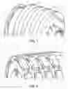Fig. 02 - Method for attenuating vibrations in the braked wheels of aircraft