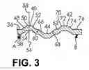 Fig. 04 - Extrusion resistant gasket