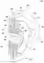 Fig. 01 - Quick connect firewall seal for firewall