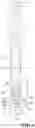 Fig. 05 - Adjustable extension arm device