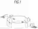 Fig. 02 - Fastening system for flush mounting a device and flush-mountable device