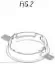 Fig. 03 - Fastening system for flush mounting a device and flush-mountable device