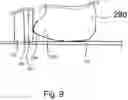 Fig. 11 - Solid fuel burning system with electronic ignition