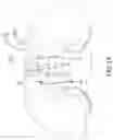 Fig. 21 - Solid fuel burning system with electronic ignition