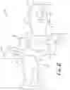 Fig. 03 - Refractory anchor device and system