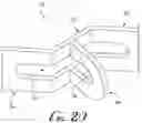 Fig. 15 - Refractory anchor device and system