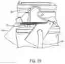 Fig. 22 - LOADING CARTRIDGES INTO A FIREARM MAGAZINE