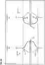 Fig. 31 - Line-based limb control system and method for archery bows