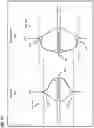 Fig. 33 - Line-based limb control system and method for archery bows