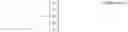 Fig. 02 - Tire-side device and tire apparatus including the same