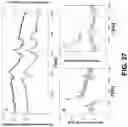 Fig. 37 - Soft shear force resistive sensor embedded in artificial skin