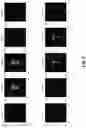 Fig. 07 - Particle emission tomography