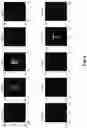 Fig. 08 - Particle emission tomography