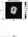 Fig. 09 - Particle emission tomography