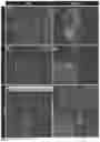 Fig. 03 - Diagnostic tool to determine podocyte foot process effacement